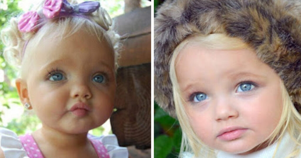 She was labeled a real-life doll when she was just 2 years old – wait and see how she looks today, many years later
