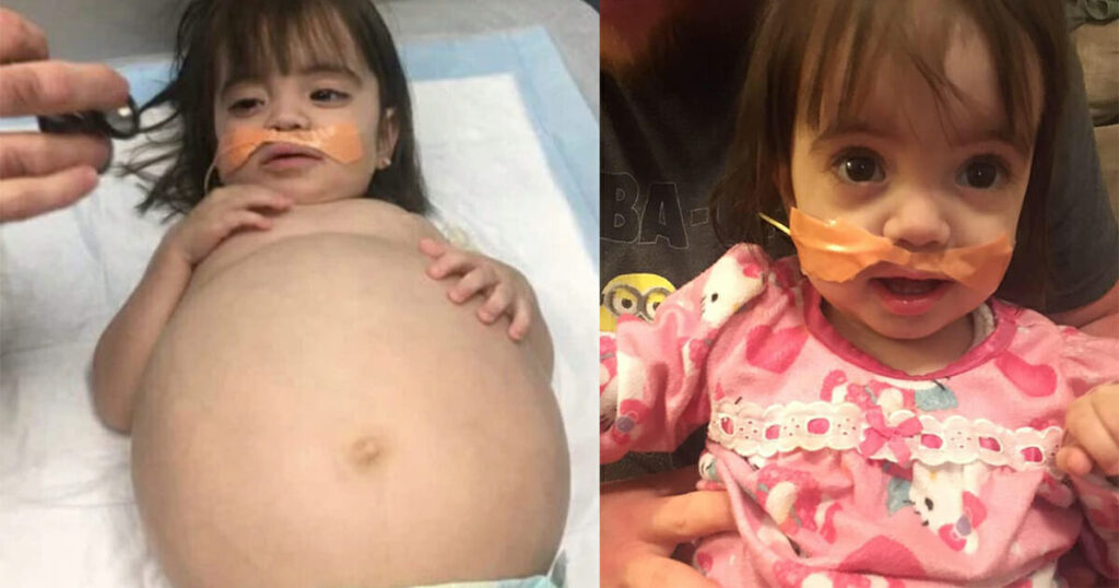 Little girl gets life-saving kidney operation thanks to her dad